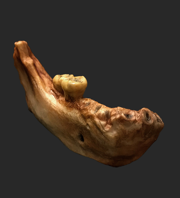 Denisovan mandible, 35,000–50,000 years ago